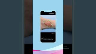 Cutimed Wound Navigator Your smart app for individual wound care English [upl. by Lanctot]