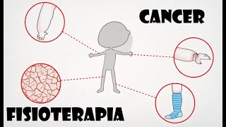 Agentes Físicos  Paciente Oncologicos Fisioterapia Como Utilizarlos [upl. by Nihahs259]