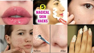 5 Magical Beauty HACKS Using TOOTHPASTE l PimplesDark SpotsPink Lips Blackheads Whiteheads l Tips [upl. by Iaht]