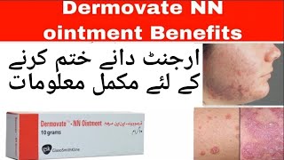 Dermovate NN ointmentHow to use dermovate for skin fungal infections remove acne pimple scar [upl. by Gina]