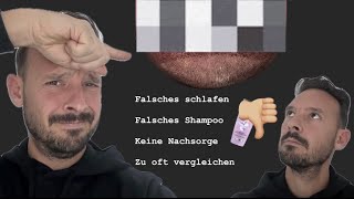 Fehler nach der Haartransplantation  Tipps um Sie zu vermeiden [upl. by Iroj399]