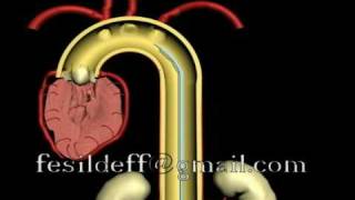 IABP Intraaortic Ballon Pump [upl. by Akcira113]