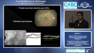 OCT normal y usos actuales de la angiografía retiniana  Dr José Luis Guerrero Naranjo [upl. by Winograd]