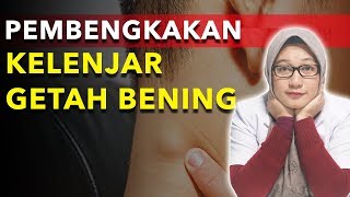 LEHER SAKIT BENGKAK ADA BENJOLAN APAKAH KANKER KELENJAR GETAH BENING  INI CARA MENGATASINYA [upl. by Younger]