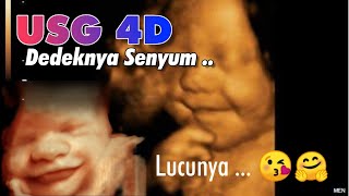 USG 4D Kehamilan 7 Bulan Dedek Bayinya Senyum Lucunya 🤗 USG 4D KEHAMILAN [upl. by Danika450]