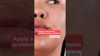 How To Video BP Acne Spot Treatment [upl. by Ellatnahc525]