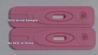 Human Chorionic Gonadotropin HCG  Pregnancy Test Tamil [upl. by Martsen195]