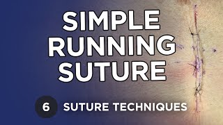 Simple Running Suture  Learn Suture Techniques [upl. by Sharos473]