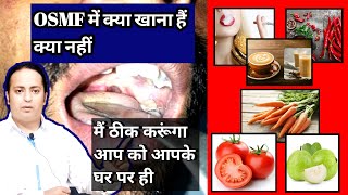 मैं ठीक करूंगा आप को आपके घर पर ही। OSMF treatment at home। submucous fibrosis treatment in India [upl. by Nicoli]