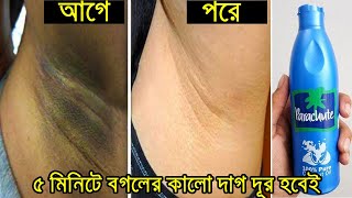 কথা দিচ্ছি নারকেল তেল দিয়ে বগলের কালো দাগ দূর হবেই  Dark Underarms Whitening  Beauty Touch [upl. by Luanne592]