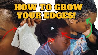 Postpartum hair loss with sisterlocs Hair Growth Tips that helped me [upl. by Ellegna]