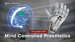 ThoughtControlled Prosthetics A BrainComputer Interface Breakthrough [upl. by Jordanna10]