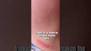 Watch This Before Using Hair Removal Creams ⚠️Dermatology Tips [upl. by Olshausen294]