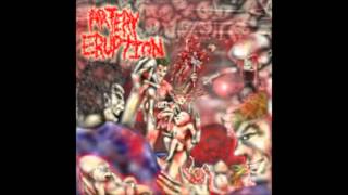 Artery Eruption  quotRipped with Anal Forcepsquot HQ [upl. by Neraj676]