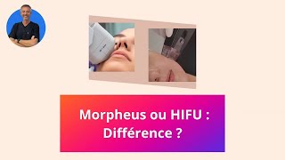 Radiofréquence Morpheus 8 ou Ultrasons HIFU  Lequel choisir  Quelles différences [upl. by Hagood]