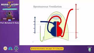 HeartLung Interactions During Mechanical Ventilation [upl. by Kafka658]