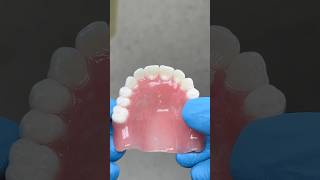 Maxillary Process Denture lsk121shorts dentist [upl. by Eiresed907]