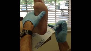 Injection for heel spur plantar fasciitis [upl. by Sutton773]