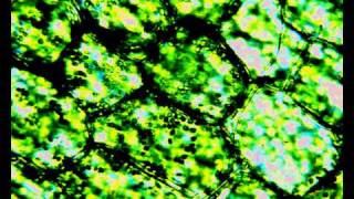 Plasmolysis in elodea cells lauren [upl. by Suirada]