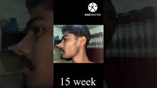 Kirkland minoxidil beard journey 4 months transformation🥰 Beard solution shorts india [upl. by Abigael534]