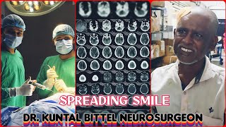 Spreading Smile  Chronic Subdural Hematoma  SDH  Complete Recovery  NEET UG  NEET PG  NEET SS [upl. by Doralin]