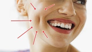 Simple Facial Exercises to Get Dimples Naturally [upl. by Ahseinaj291]