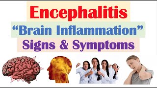 Encephalitis “Brain Inflammation” Signs and Symptoms amp Why They Occur [upl. by Ybsorc]