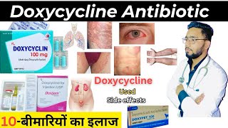 Doxycycline  एंटीबायोटिक  Medicine  Treatment  Antibiotics  doxycycline medicine Used [upl. by Egrog]