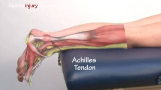 Achilles Tendonitis  Tendinopathy  Explained in 90 Seconds [upl. by Nylkaj]