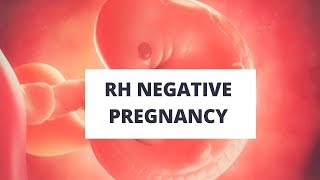 Rh negative pregnancy [upl. by Nova]