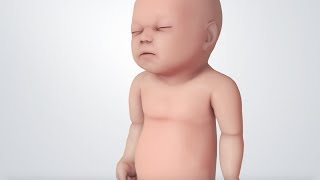 Infant Distress Warning Signs Grunting Baby Sound [upl. by Eirrem887]