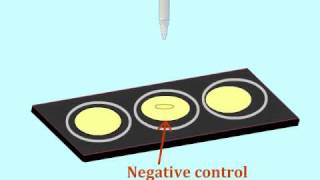 Agglutination assay to detect antigens  MultiLingual Captions [upl. by Henka]