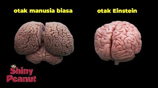 Inilah yang Membuat Albert Einstein Berbeda dari Manusia Normal [upl. by Jurkoic210]