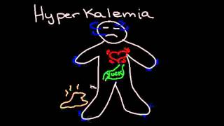 Hyperkalemia [upl. by Essirehs406]