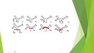 biliary leaks  approach to diagnosis and treatment [upl. by Nnyladnarb657]