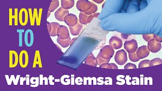 How to do a hematology stain WrightGiemsa stain Laboratory Tutorial Procedure [upl. by Cohla]