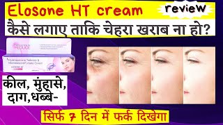 Elosone ht Cream Review  Elosone HT Use Benefits And Side Effects  Dark spot  Pharmacist Kunduji [upl. by Barstow614]