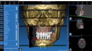 Odontoiatria Digitale Le basi gli strumenti il futuro dalla CBCT alla stampante 3D [upl. by Eeuqram]