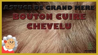 Astuce grandmère bouton cuir chevelu [upl. by Anawal]