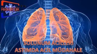 SOLUNUM Acilleri  Astım Krizinde Acil Müdehale Nasıl Olmalıdır [upl. by Terra312]