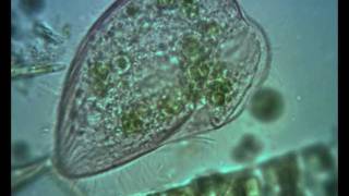 Blepharisma ciliate Contractile Vacuole in Action [upl. by Julita581]