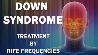 Down Syndrome  RIFE Frequencies Treatment  Energy amp Quantum Medicine with Bioresonance [upl. by Ginger]