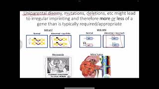 Epigenetics imprinting uniparental disomy and randomly Xlinked  trinucleotide repeat diseases [upl. by Eivad]