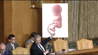 Democrats cut off Kennedy in Budget for highlighting horrors of abortion [upl. by Androw191]