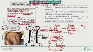 Hematología  Leucemias linfoide cronica leucemia mieloide cronico smpc [upl. by Yemerej513]