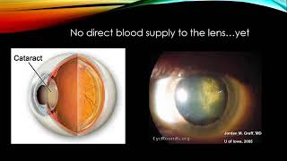 BEMER Eyes 1 hr with Dr Todd Wylie OD [upl. by Strep]