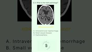 Head and Spine Buzz 3 radiologychannel007 [upl. by Solon]