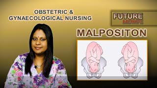 FETAL MALPOSITIONDHANYA DEEPUHIGH RISK LABOUR [upl. by Tanny802]