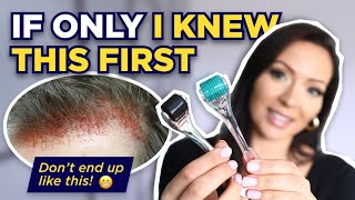 The Dermaroller Watch This BEFORE Microneedling What I wish I knew Before I Started Dermarolling [upl. by Maybelle]