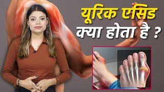 Uric Acid क्या होता है Body में ये क्यों बढ़ता है Symptoms और Reason Treatment  Boldsky [upl. by Hak]